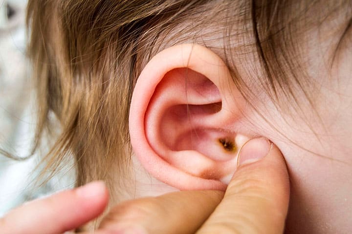 How To Clean Baby Earwax: Safety And When To See A Doctor