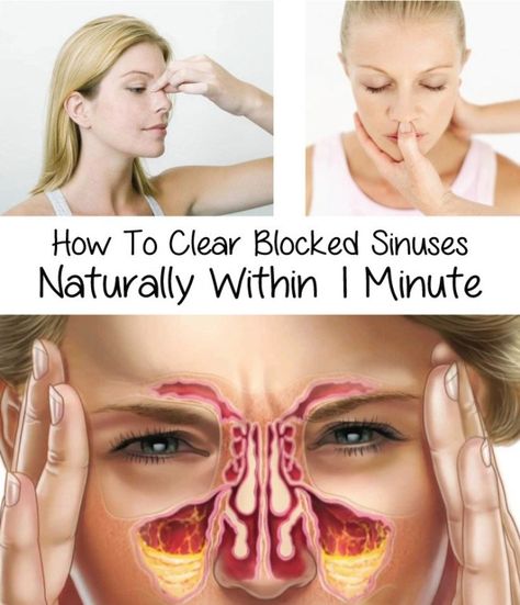 How To Clear Blocked Sinuses Naturally Within 1 Minute