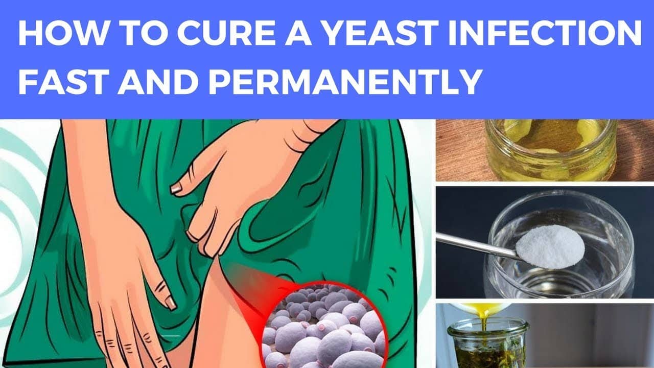 How To Cure A Yeast Infection Fast And Permanently