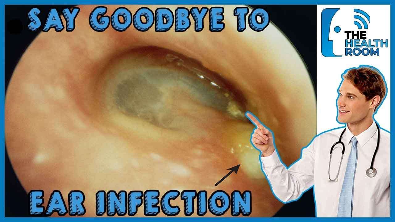 How to CURE EAR INFECTIONS at Home 10 Ways (2021)