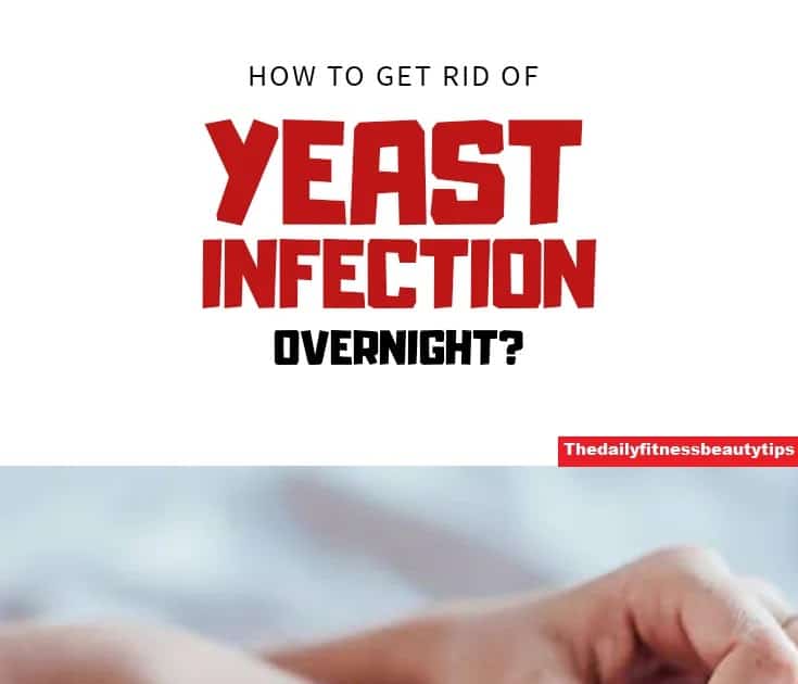 How to Get Rid Of A Yeast Infection In 24 Hours?