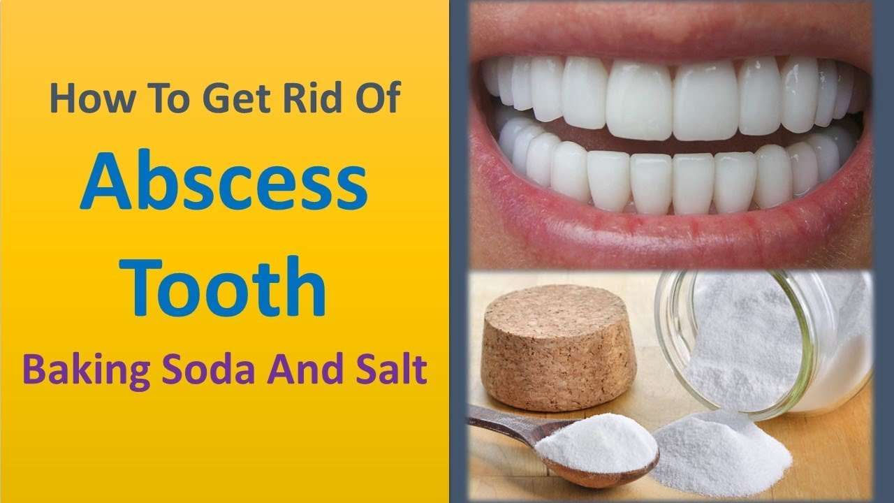 how to get rid of abscess tooth