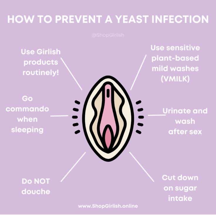 How to prevent a yeast infection! in 2021