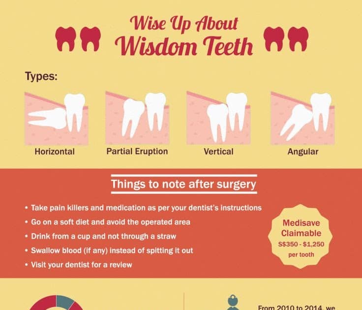 How To Reduce Wisdom Teeth Removal Swelling