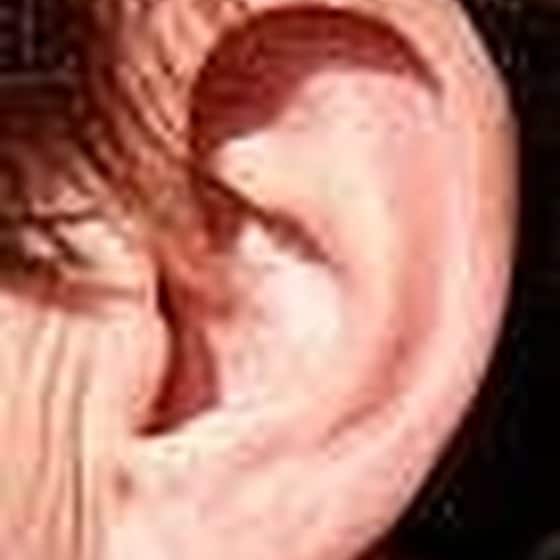 How to Treat A Popping Ear