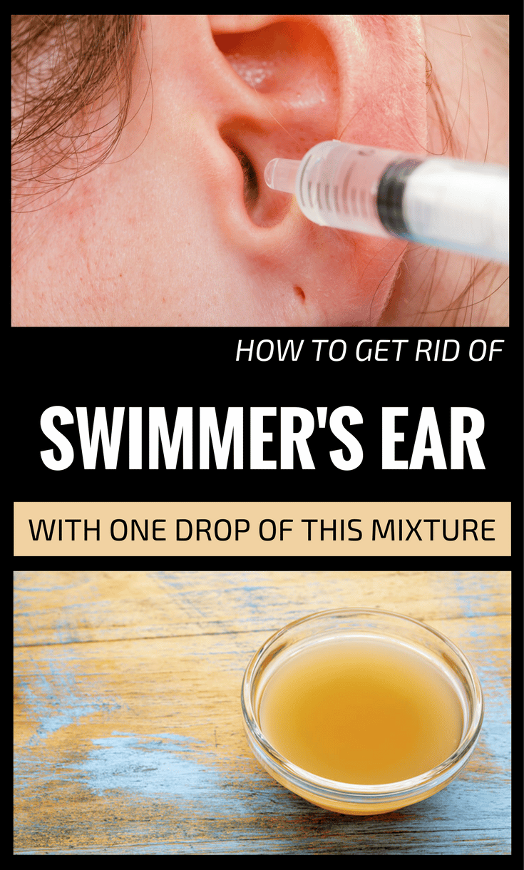 How To Treat Ear Infection With Ginger  ho.modulartz.com