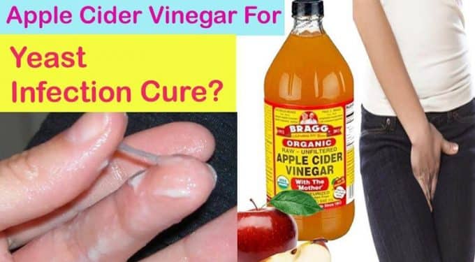How To Use Apple Cider Vinegar For Yeast Infection?