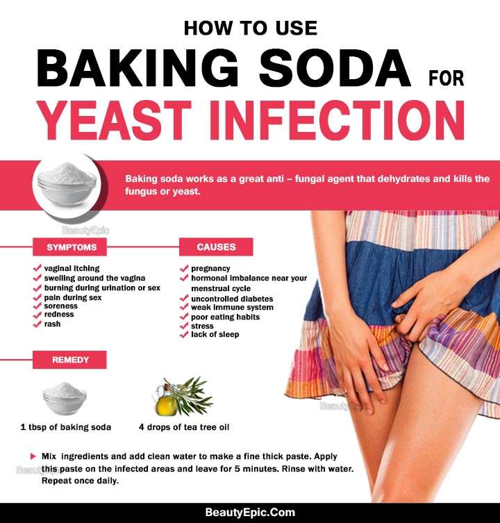 How to Use Baking Soda for Yeast Infection?