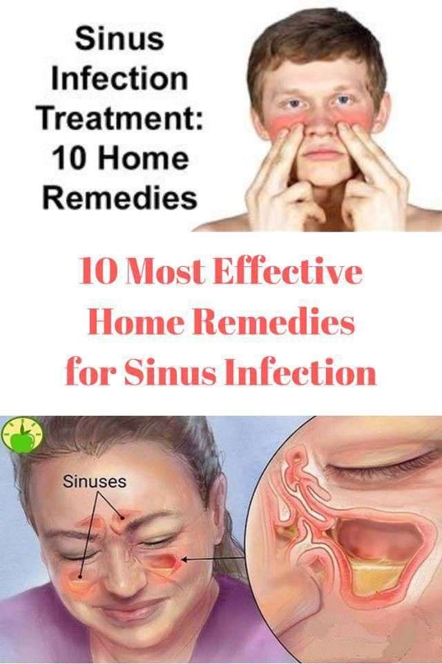 If you suffer from sinus infections, then here are the ...