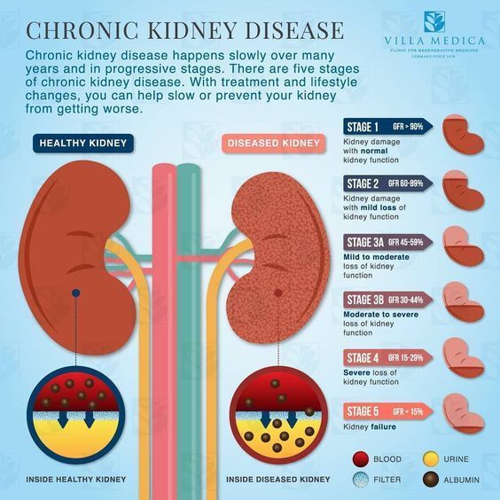 Kidney Disease Urine Color Kidney Failure