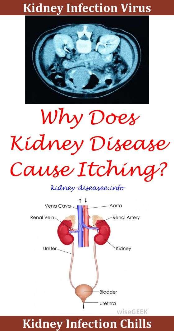 Kidney Infection Urgent Care Or Er