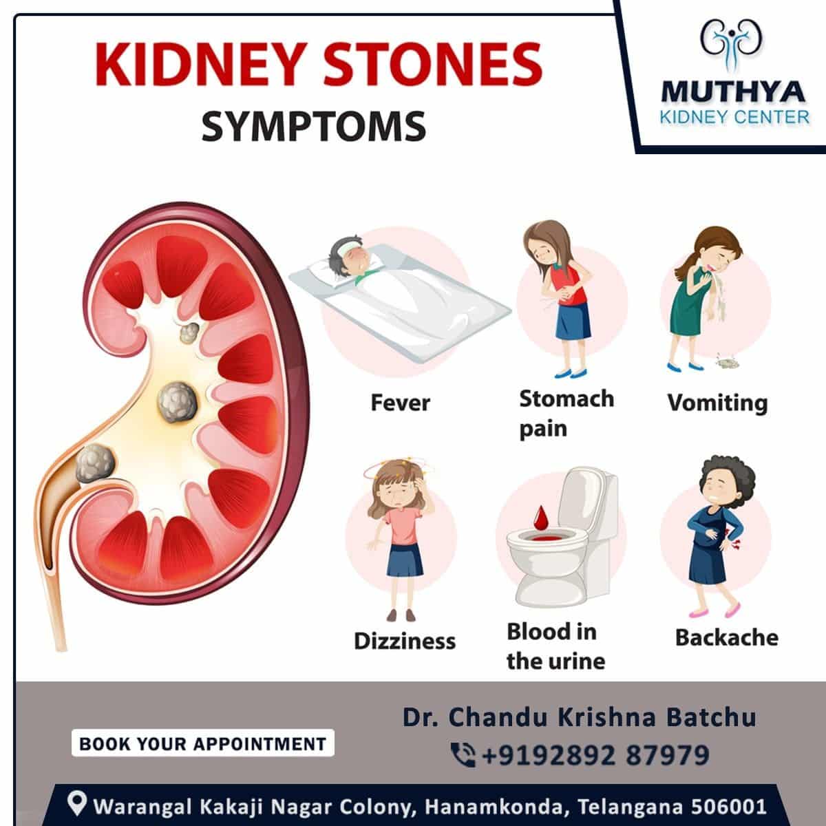 Kidney stones form in your kidneys. As stones move into your ureters ...