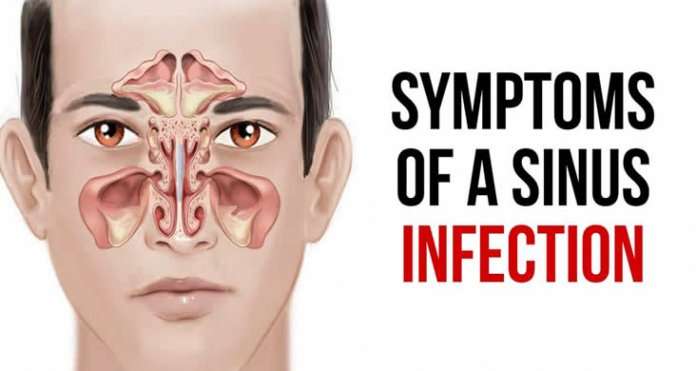 Know In Details About The Symptoms, Causes And Treatment ...