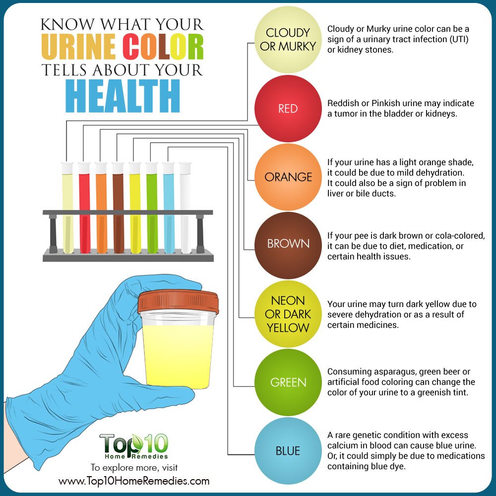 Know what Your Urine Color Tells about Your Health