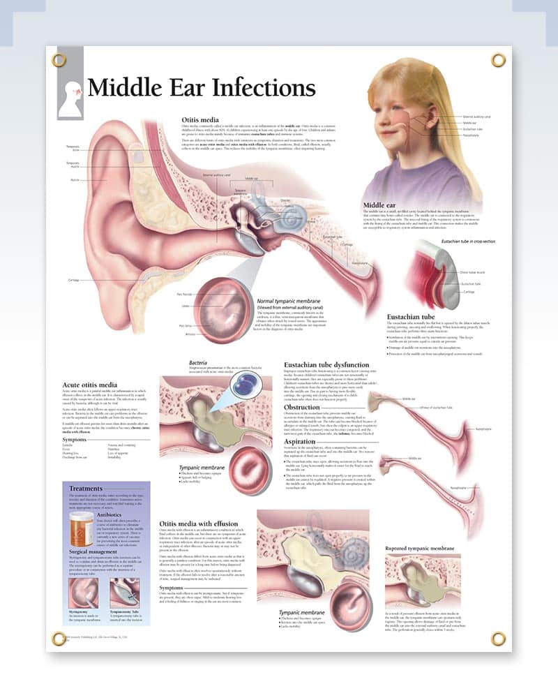 Middle Ear Infections Exam