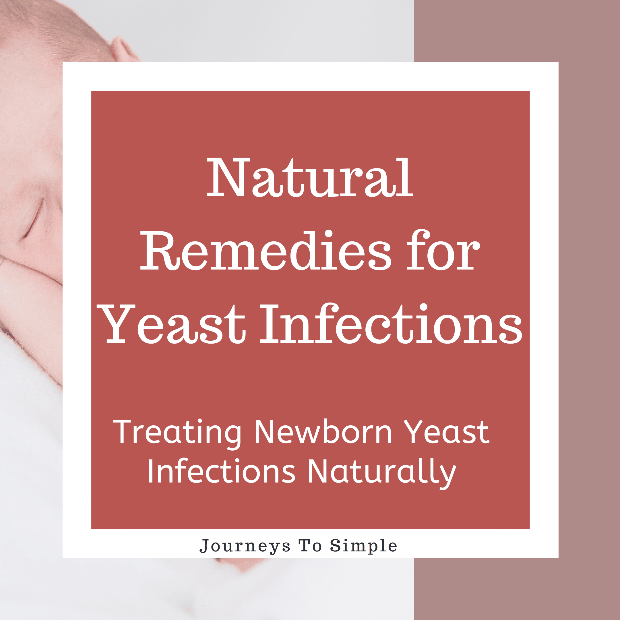 Natural Home Remedies for Yeast Infections in Babies