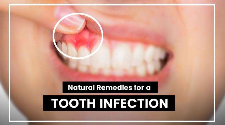 Natural Remedies For a Tooth Infection