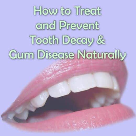 Natural Remedies to Prevent and Heal Gum Disease Naturally