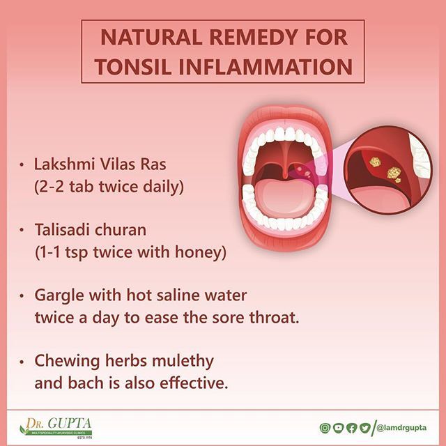 Natural remedy for tonsil inflammation: