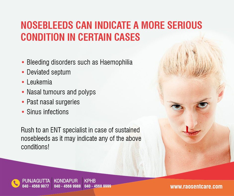 Nosebleed can indicate a more serious condition in certain cases https ...