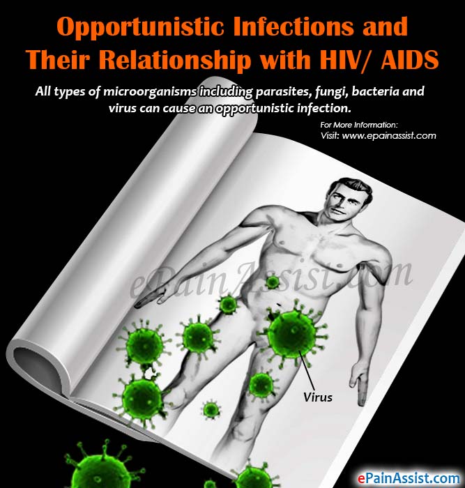 Opportunistic Infections and Their Relationship with HIV/AIDS