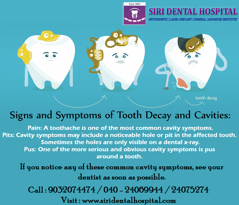 Pin on Dental doctors in Hyderabad