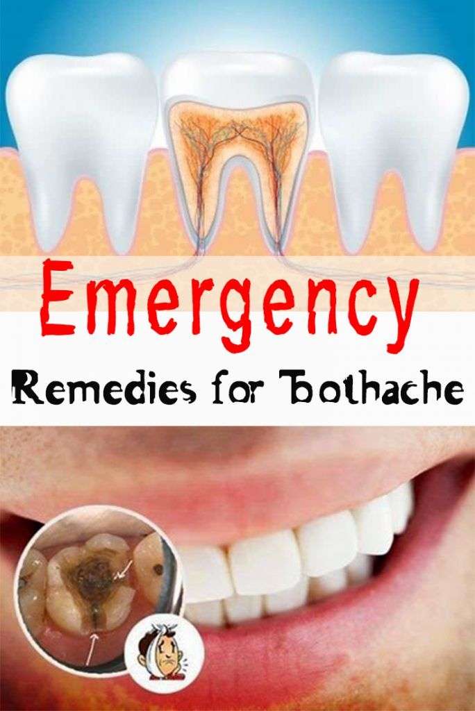 Pin on Tooth pain remedies