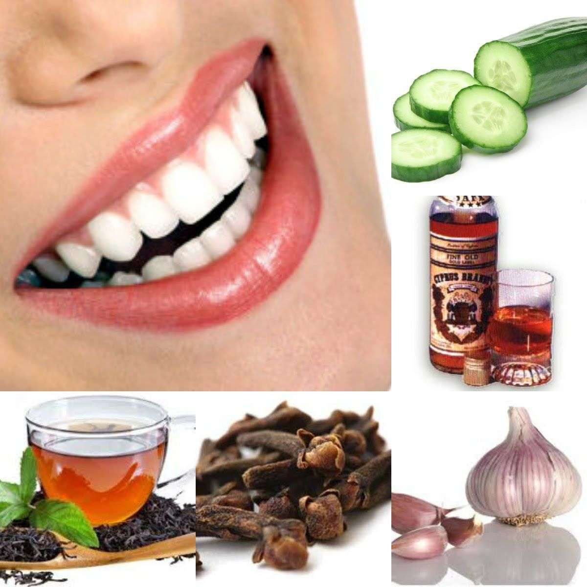 Pin on Wisdom Teeth Pain Relief, Abscess Tooth Home Remedy ...