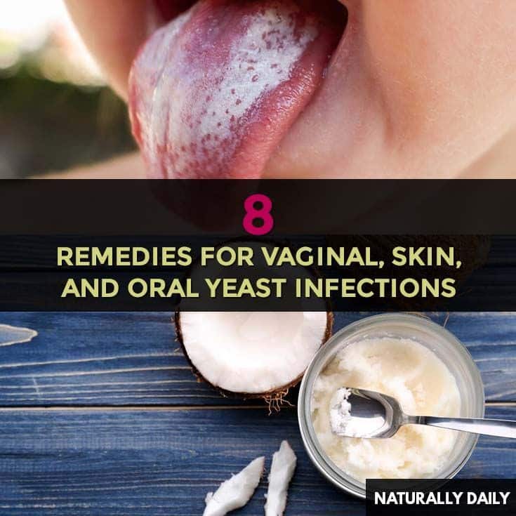 Pin on yeast infection relief