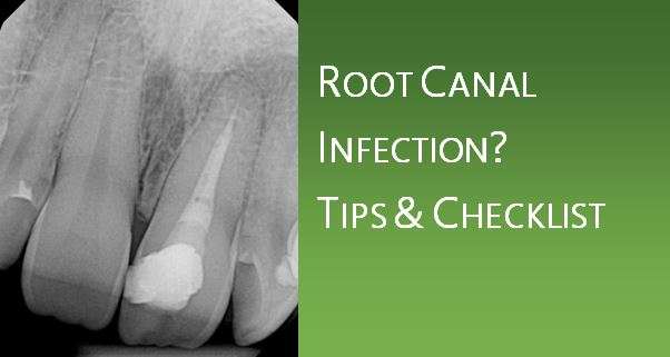 Root Canal Infection