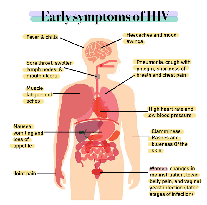 Signs and symptoms of HIV/AIDS