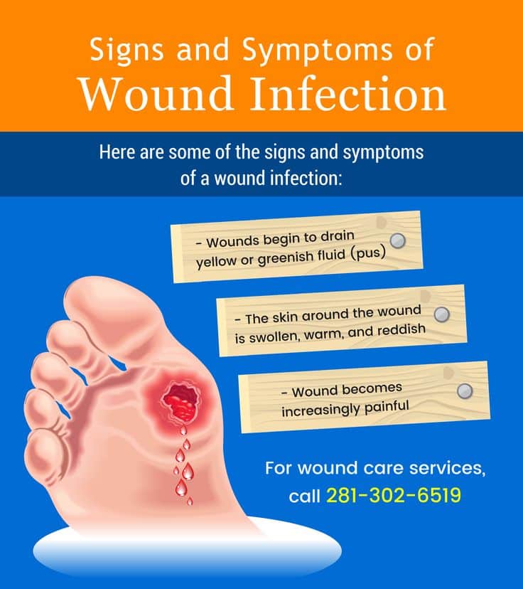 Signs and Symptoms of Wound Infection #homecare #woundcare #woundinfection