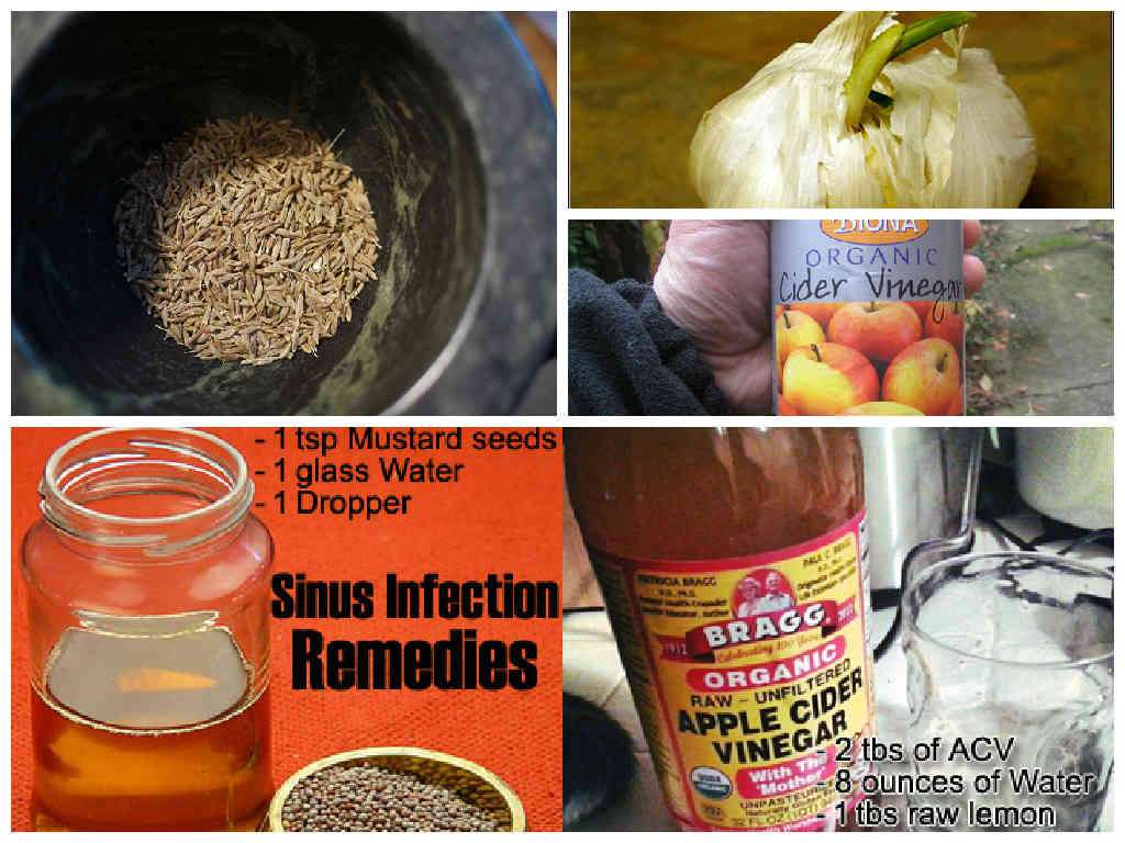 Simple Home Remedies for Sinus Infection