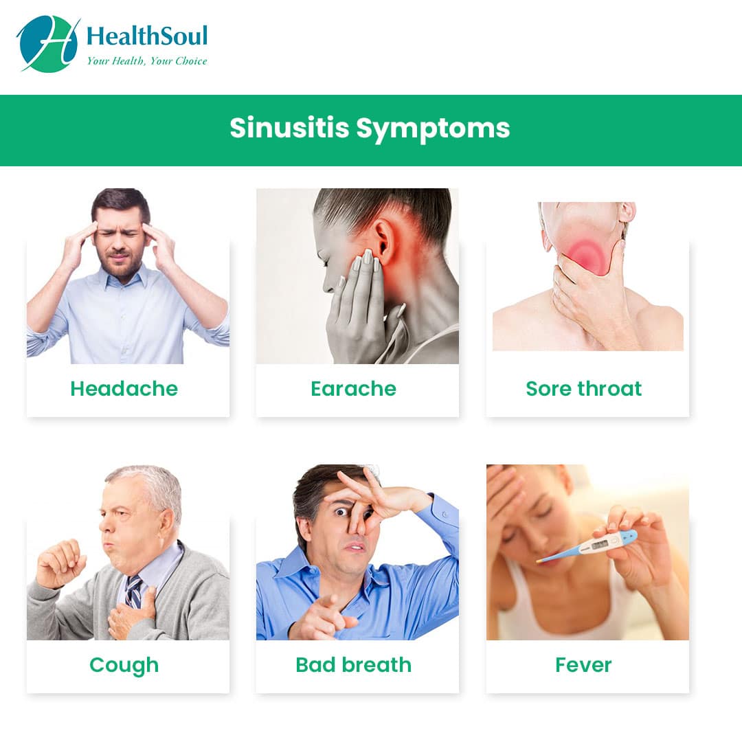 Sinusitis: Symptoms, Diagnosis and Treatment  Healthsoul