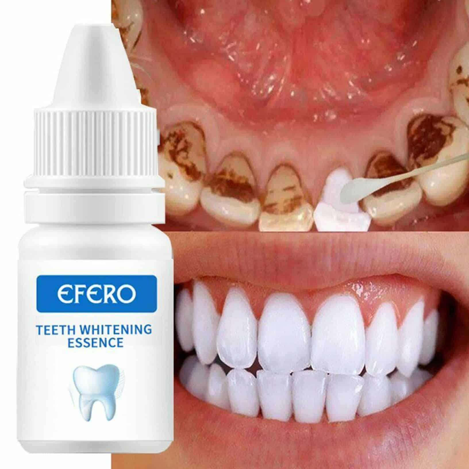 Teeth Whitening Serum Gel Dental Oral Hygiene Effective Remove ...