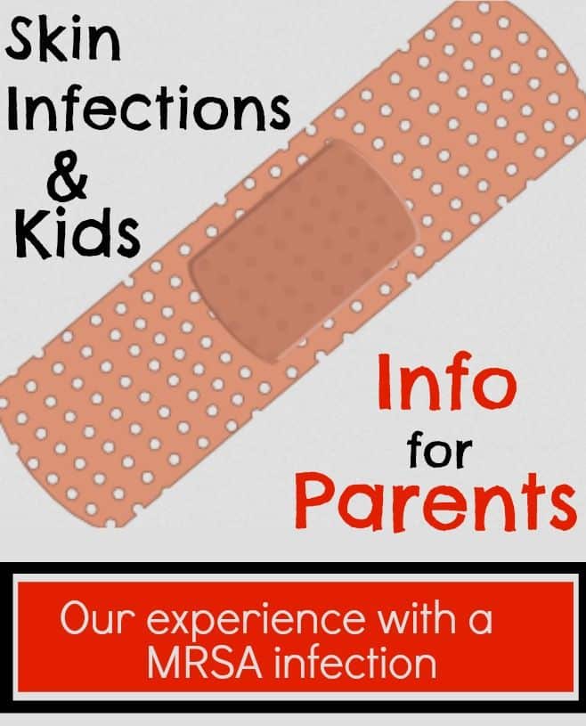 The seriousness of skin infections &  kids