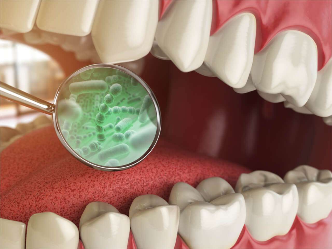 Things You Need to Know about Tooth Infection Sepsis ...