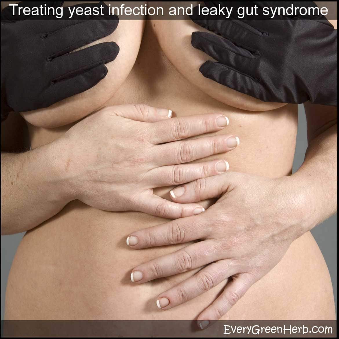Tips for treating candidiasis and yeast infections with medicinal herbs ...