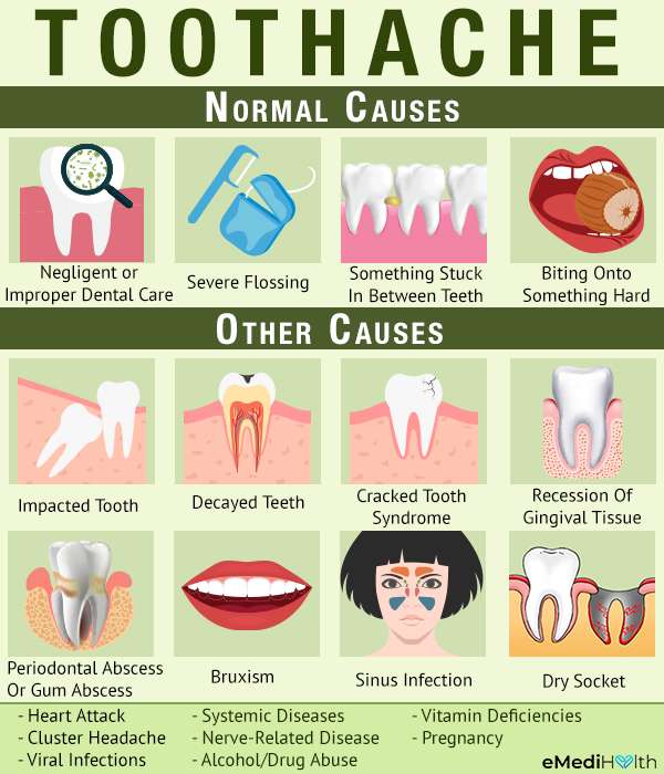 Toothache 101: Causes and Treatment