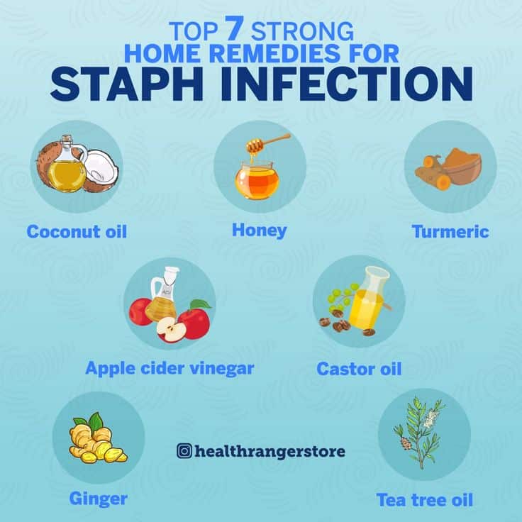 Top 7 Strong Home Remedies For Staph Infection [Video]