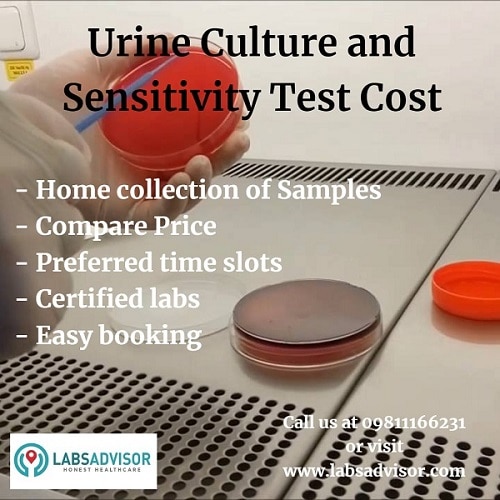 Up to 50% OFF on Urine Culture Test Price