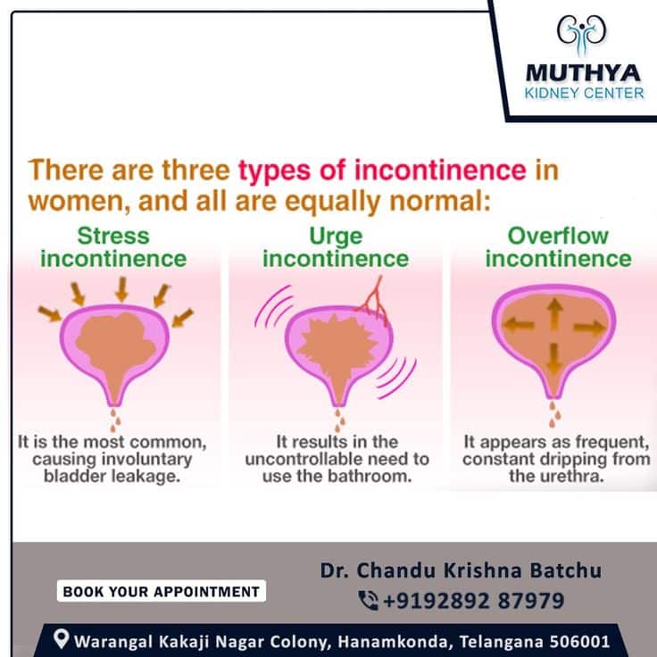 Urinary incontinence  the loss of bladder control  is a common and ...