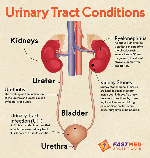 Urinary Tract Conditions [INFOGRAPHIC]