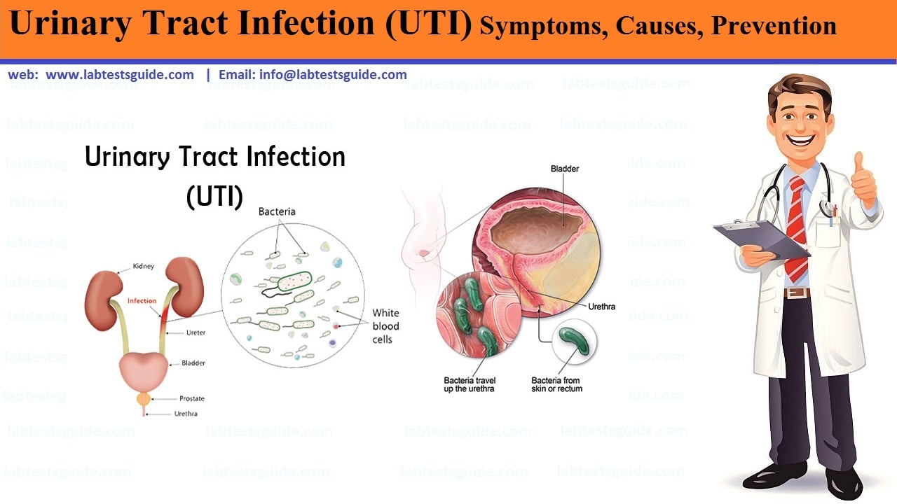 Urinary Tract Infections (UTI) Siigns &  Symptoms, Causes and more