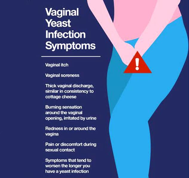Vaginal Yeast Infection: Heres How You Can Avoid The Condition