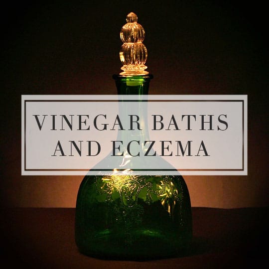 Vinegar baths and Eczema