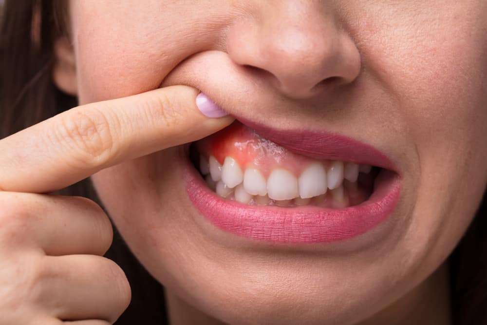 What Causes Swollen Gum Around One Tooth?