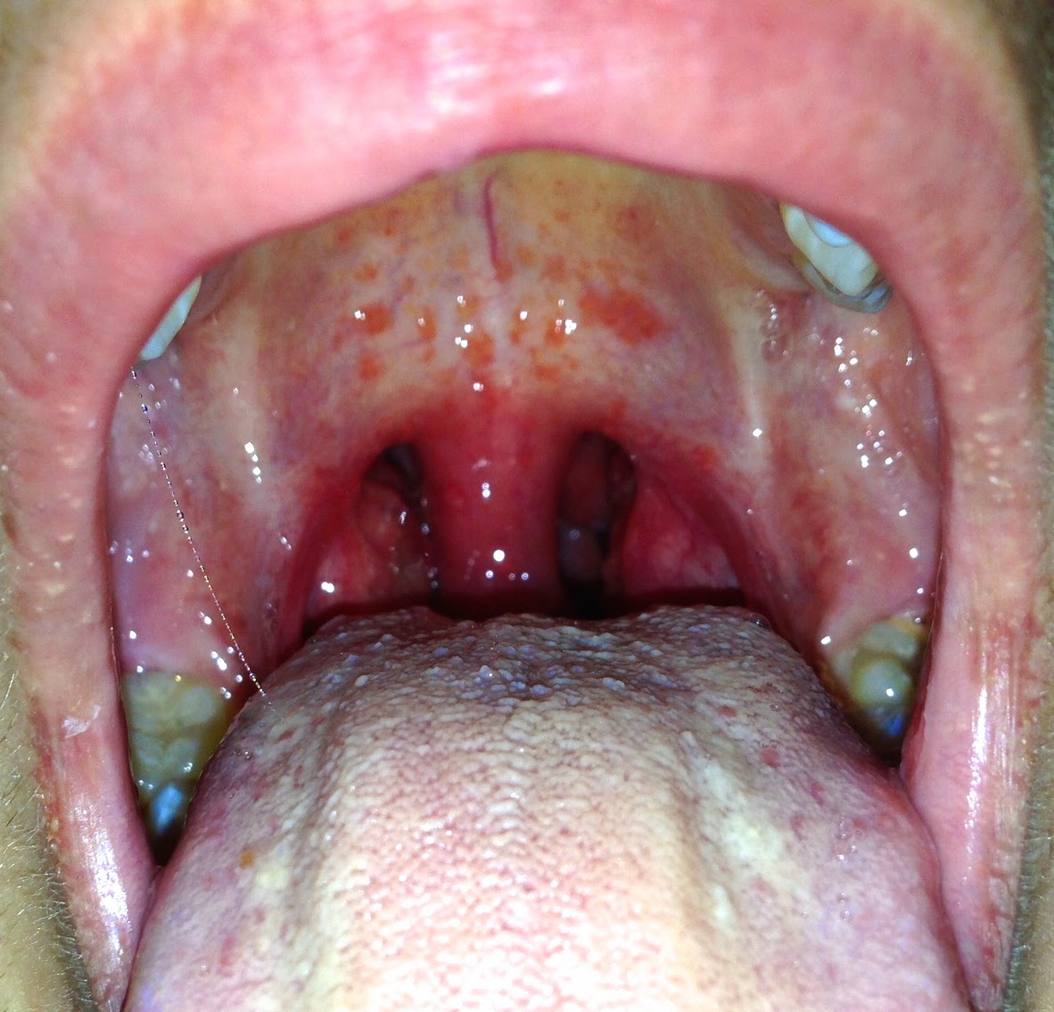 What Doctor Should I See For Strep Throat