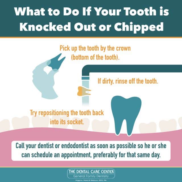 What Should You Do if Your Tooth is Knocked Out or Chipped?