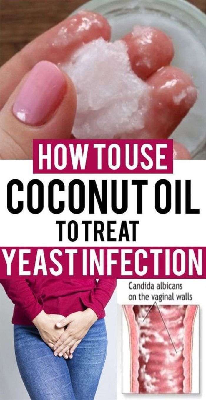 What To Do For Yeast Infection